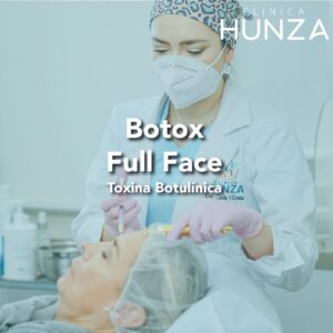 Botox Full Face