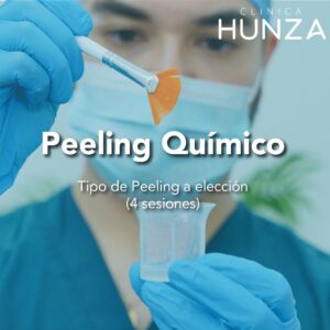 Peeling Químico